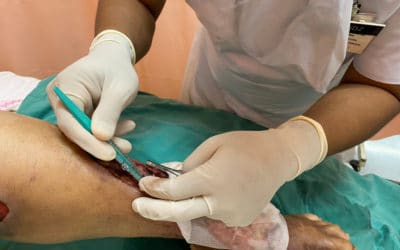 Debridement Auditing – It’s All About the Benchmarking
