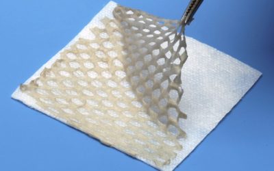 JZ Modifier Use With Skin Substitutes