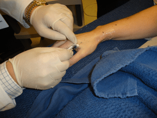 Attend the Virtual Lymphedema Seminar on October 3rd
